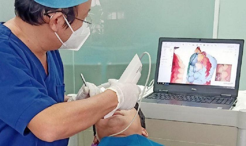 Công nghệ lấy dấu răng kỹ thuật số Oral Scan