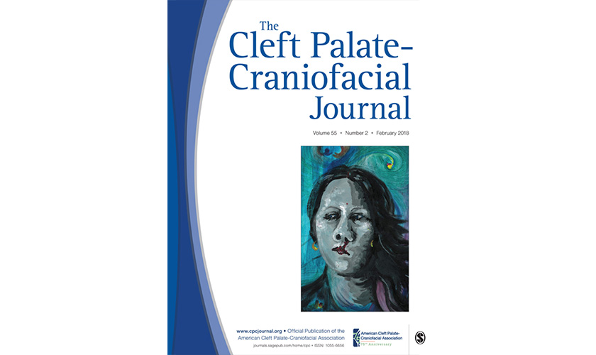 A New Technique in Alveolar Cleft Bone Grafting for Dental Implant Placement in Patients With Cleft Lip and Palate