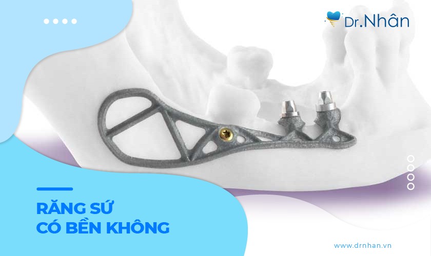 Chống chỉ định khi thực hiện Implant cá nhân hóa