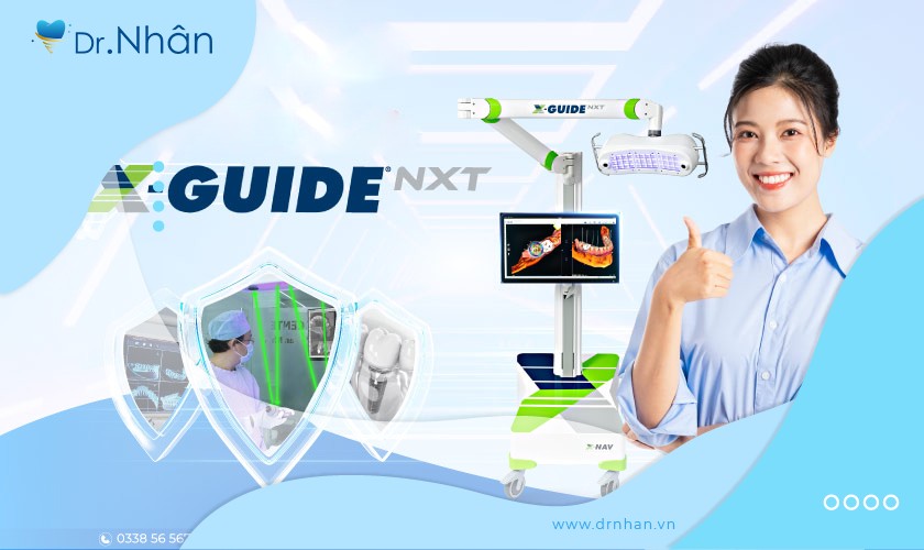 Ứng dụng công nghệ định vị X-Guide trong thiết kế implant cá nhân hóa