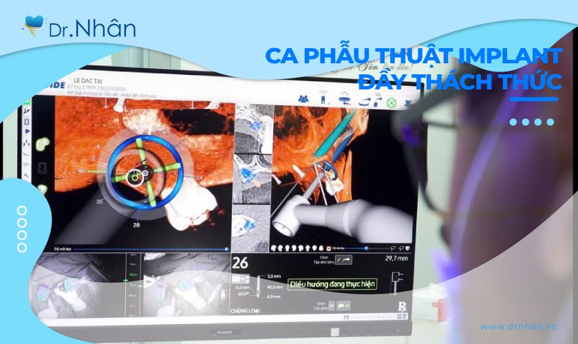 Ca Implant đầy thử thách: Thành công nhờ kết hợp giữa kinh nghiệm và công nghệ hiện đại