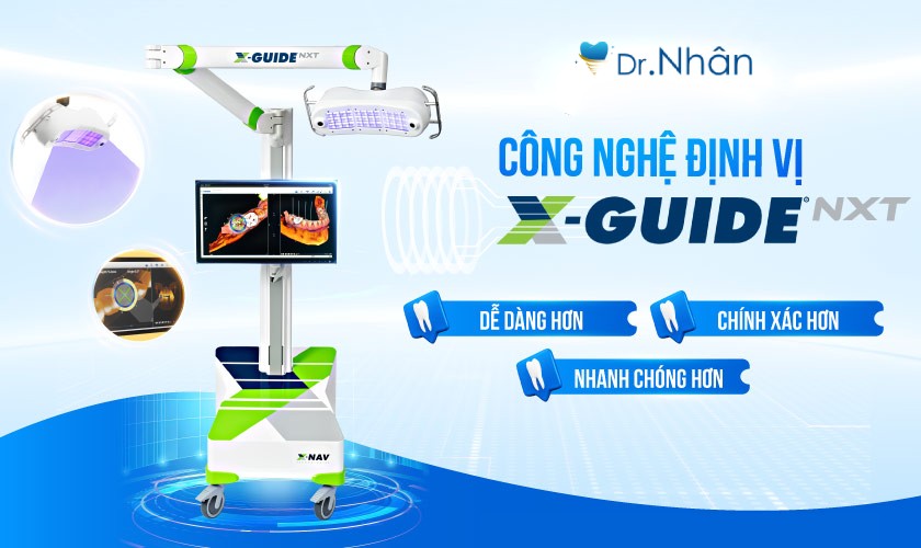 Công nghệ định vị trong cấy ghép Implant Công nghệ định vị trong cấy ghép Implant