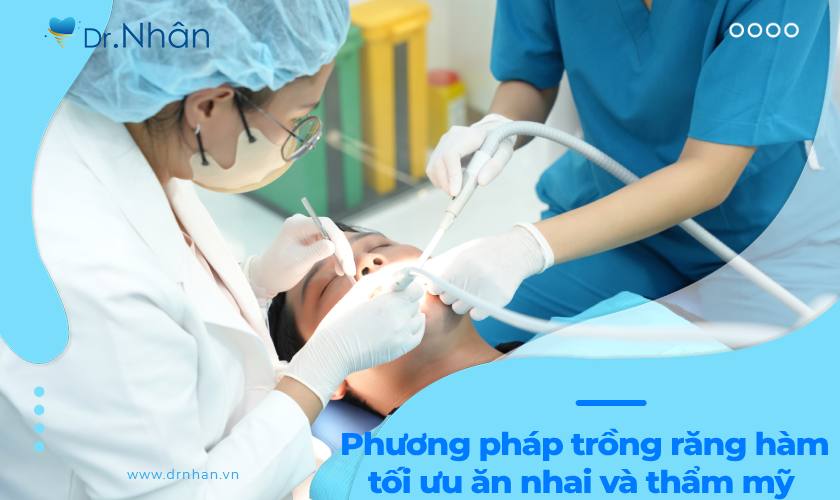 Giải pháp trồng răng hàm tối ưu ăn nhai và thẩm mỹ Giải pháp trồng răng hàm tối ưu ăn nhai và thẩm mỹ
