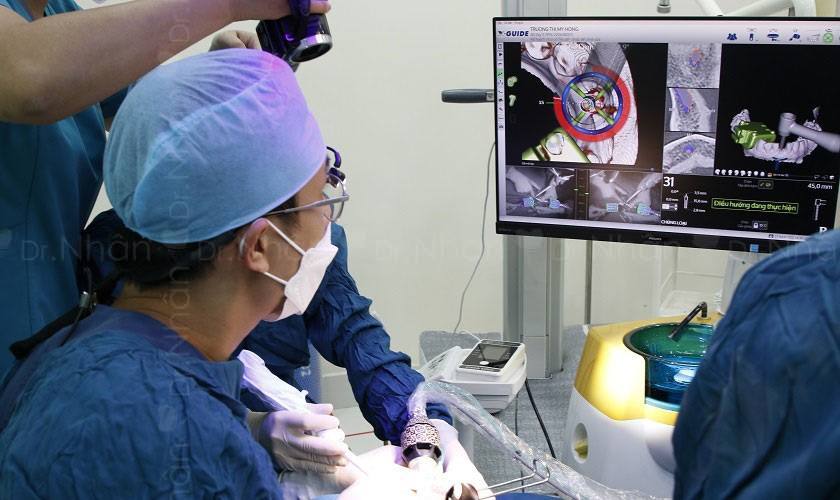 Công nghệ định vị cấy ghép Implant X-Guide Công nghệ định vị cấy ghép Implant X-Guide