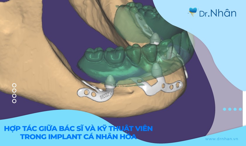 Hợp tác giữa kỹ thuật viên và bác sĩ trong chế tác implant cá nhân hóa