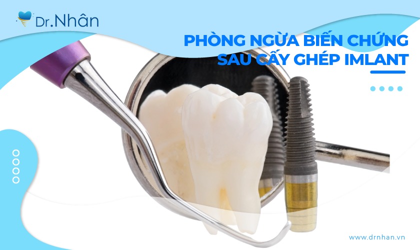 Phòng ngừa biến chứng sau cấy ghép Implant như thế nào cho hiệu quả? Phòng ngừa biến chứng sau cấy ghép Implant như thế nào cho hiệu quả?