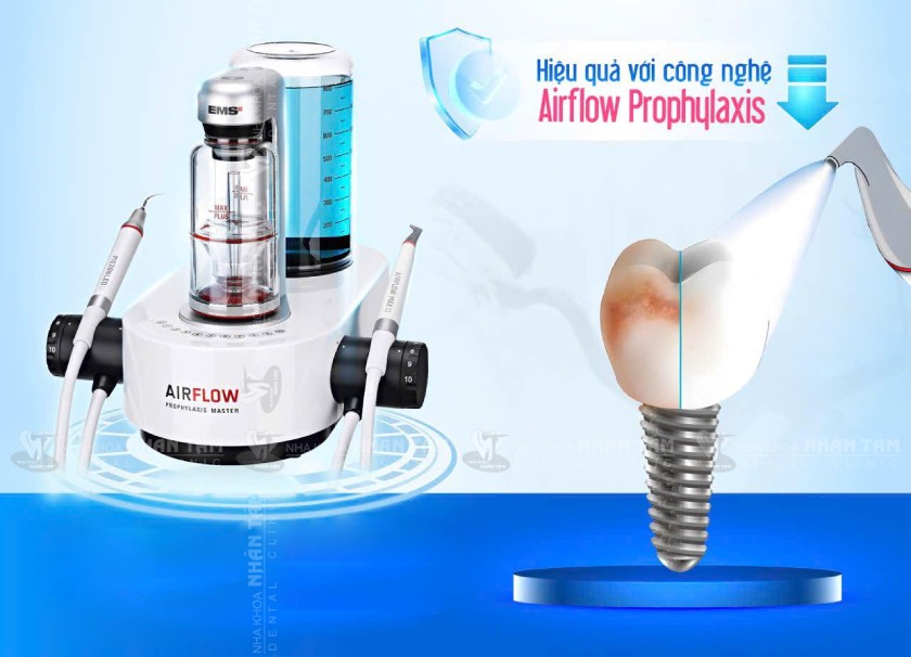 Công nghệ Airflow Prophylaxis Master Công nghệ Airflow Prophylaxis Master