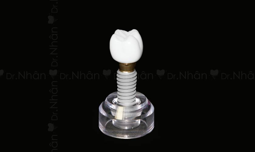 Địa chỉ trồng răng Implant uy tín cung cấp vật liệu nha khoa chính hãng, đảm bảo an toàn khi sử dụng Địa chỉ trồng răng Implant uy tín cung cấp vật liệu nha khoa chính hãng, đảm bảo an toàn khi sử dụng