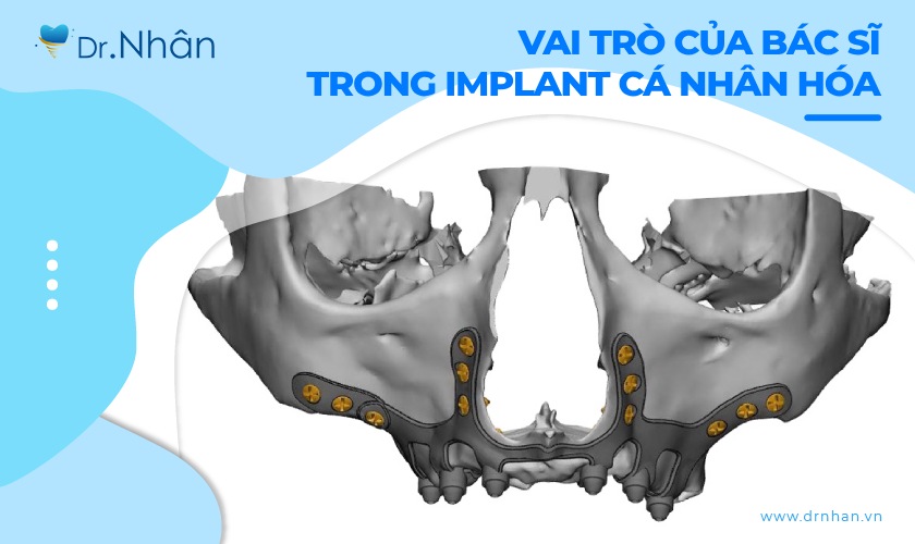 Vai trò của bác sĩ trong thành công của implant cá nhân hóa