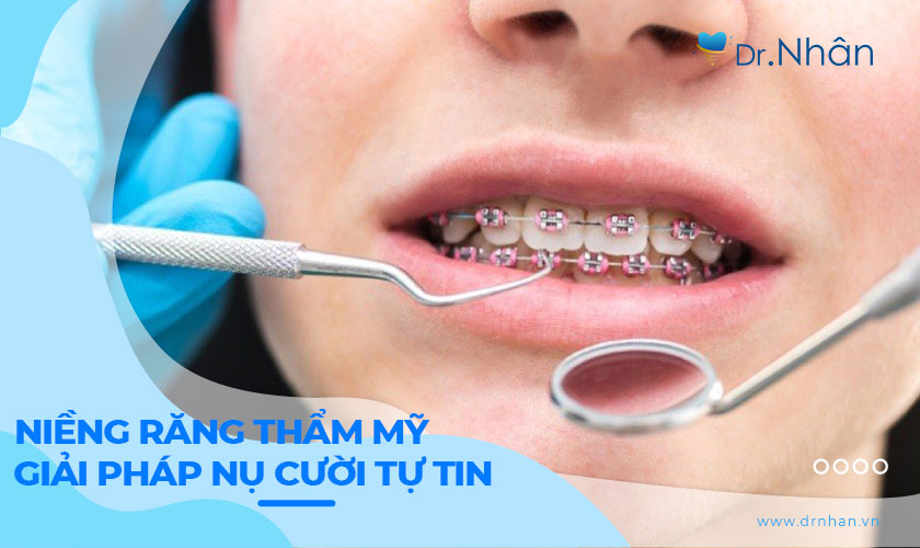 Niềng Răng Thẩm Mỹ: Giải Pháp Hoàn Hảo Cho Nụ Cười Tự Tin