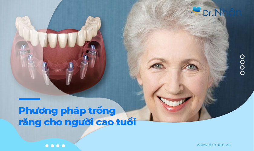 Phương pháp trồng răng nào phù hợp cho người cao tuổi?