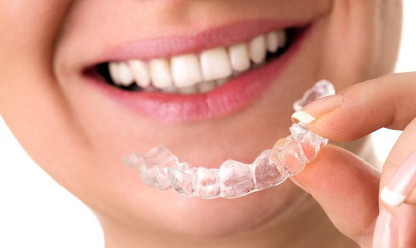 Invisalign được xem là giải pháp chỉnh nha hiệu quả nhất cho mẹ bầu mong muốn niềng răng