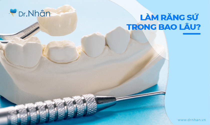 Thời gian làm răng sứ trong bao lâu?