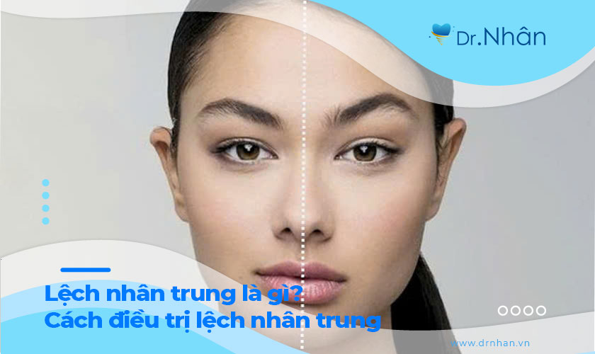 Lệch nhân trung là gì? Nguyên nhân và cách khắc phục