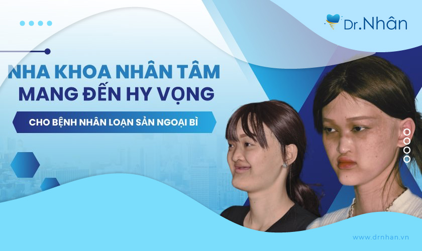 Nha khoa Nhân Tâm điều trị cho bệnh nhân loạn sản ngoại bì