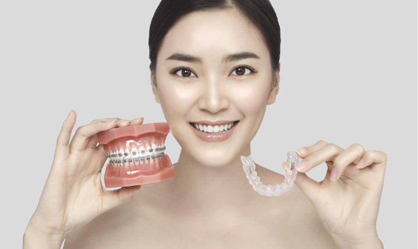 Chi phí niềng răng invisalign cao hơn so với niềng răng mắc cài