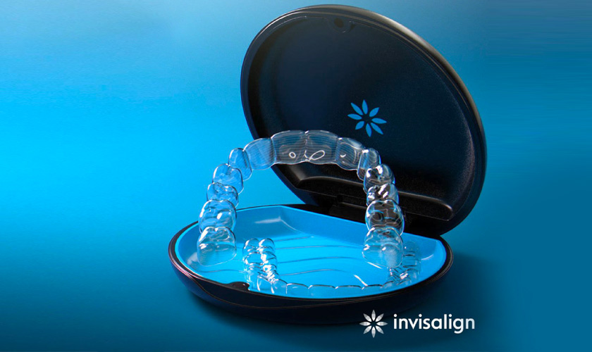 Khay niềng trong suốt Invisalign