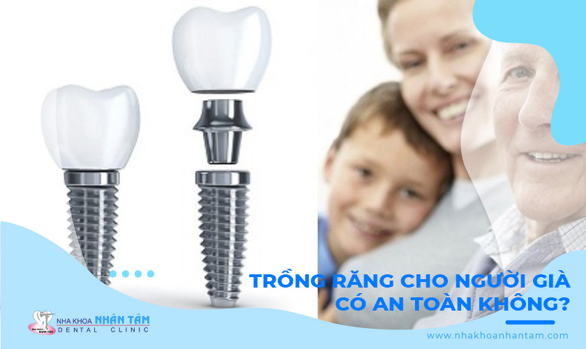 Trồng răng giả cho người già có an toàn không?