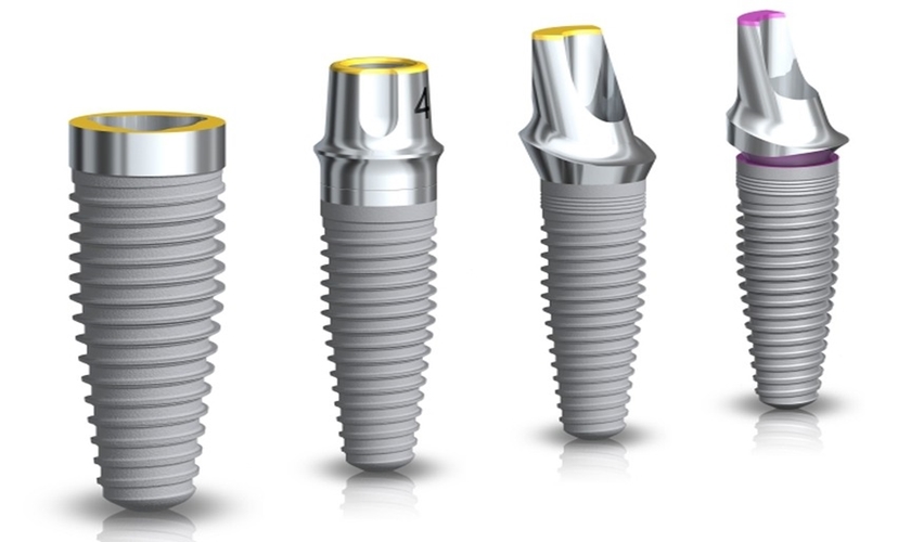 Trụ Implant cấu thành từ titanium bền vững và an toàn