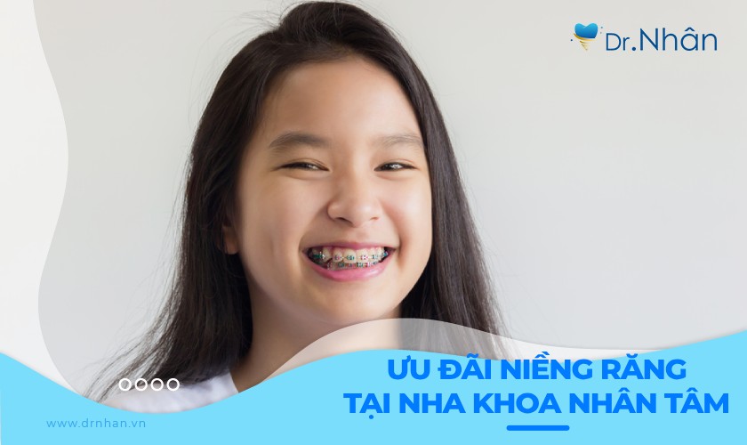 Ưu đãi niềng răng cực hấp dẫn tại Nha khoa Nhân Tâm Ưu đãi niềng răng cực hấp dẫn tại Nha khoa Nhân Tâm