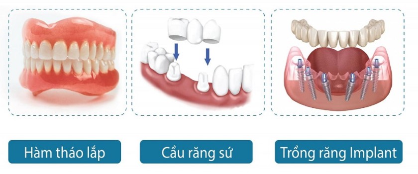 Lựa chọn phương pháp nào còn tùy thuộc vào điều kiện sức khỏe của người cao tuổi