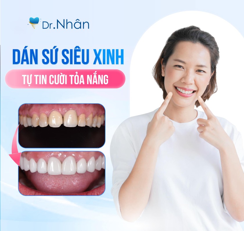 Răng sứ giúp nhiều người cải thiện diện mạo và lấy lại sự tự tin Răng sứ giúp nhiều người cải thiện diện mạo và lấy lại sự tự tin
