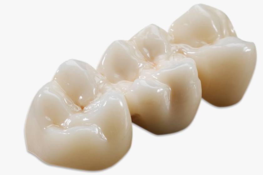Khách hàng bọc răng sứ tại Nha khoa Nhân Tâm
