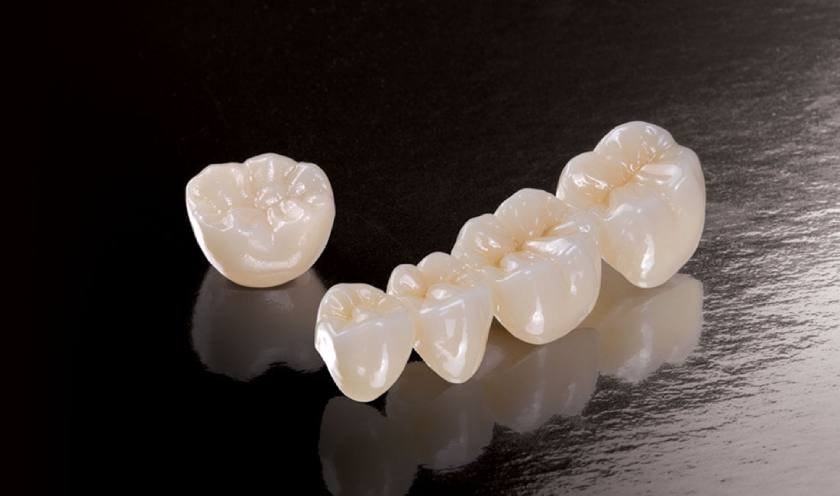 Để giữ cho răng sứ Zirconia luôn được bền đẹp, bạn cần phải lưu ý chăm sóc và bảo quản kỹ lưỡng