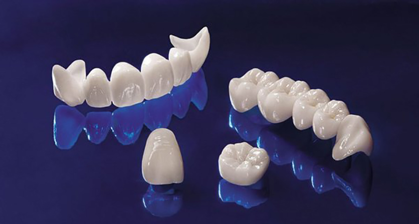 Tiêu chí của một hàm răng sứ chất lượng